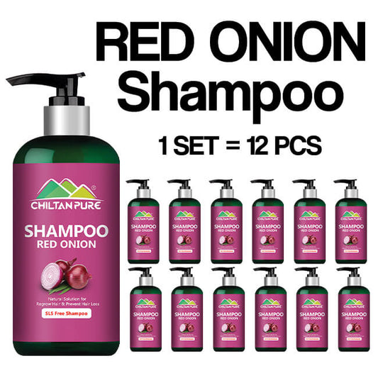 Red Onion Shampoo 🧅 Natural Solution for Regrow Hair & Prevent Hair Loss 100% Results