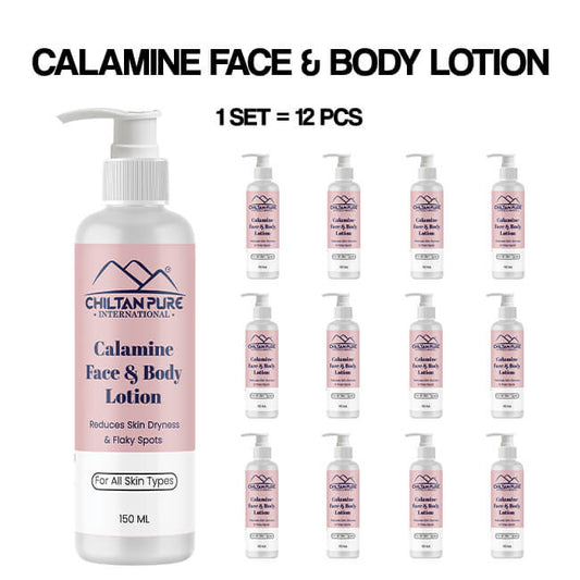 Calamine Lotion – Solution to every allergy, contains anti-allergic properties, Reduces skin dryness – 100% organic 150ml
