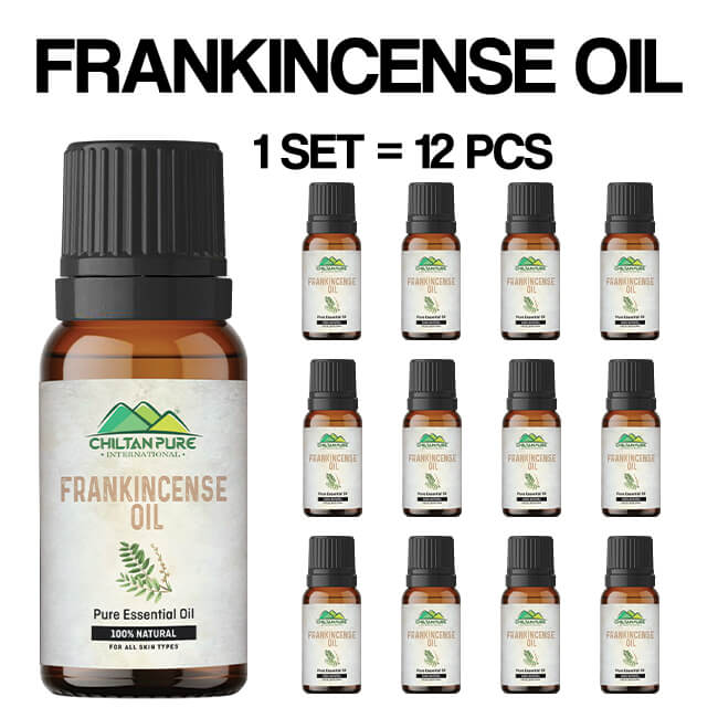 Frankincense Essential Oil – Best for Removing Dark Circles 20ml
