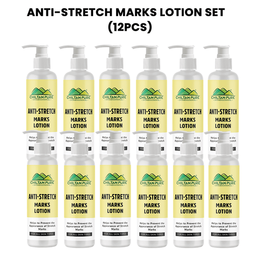 Anti-Stretch Marks Lotion – Formulated To Repair, Diminish & Prevent Stretch Marks With Intense Hydration & Smoothing, Good For Pregnancy Skincare