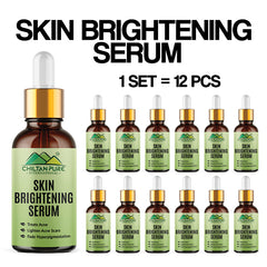 Skin Brightening Serum – Anti Aging, Brightens Skin, Treats Acne & Fade Hyperpigmentation