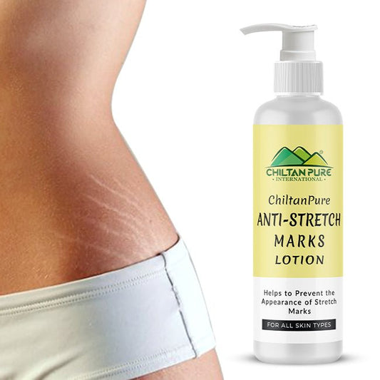 Anti-Stretch Marks Lotion – Formulated To Repair, Diminish & Prevent Stretch Marks With Intense Hydration & Smoothing, Good For Pregnancy Skincare - Mamasjan